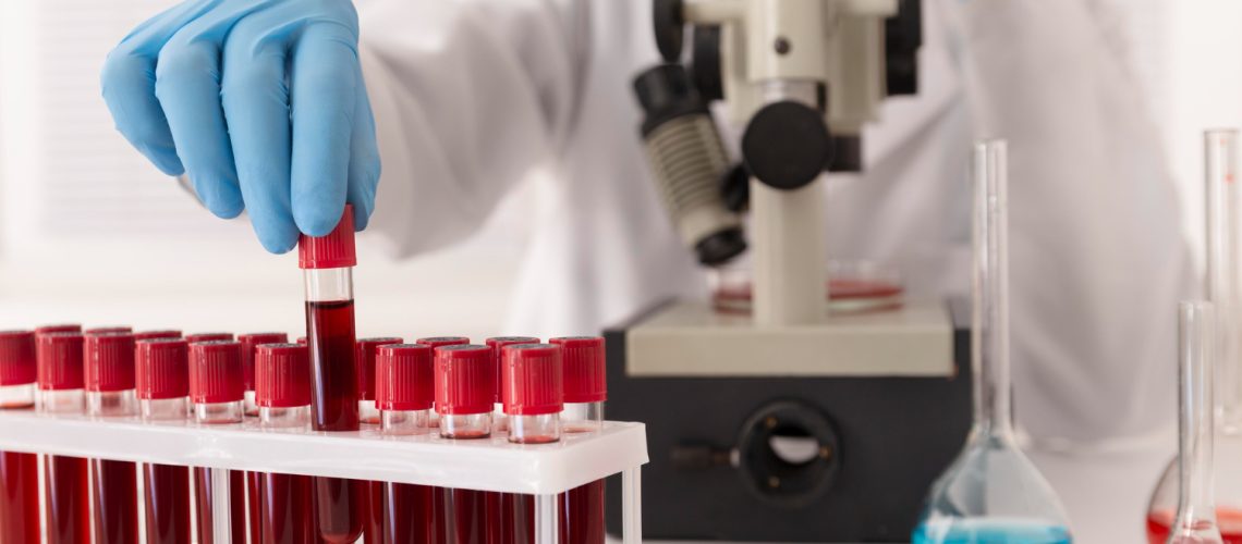 coronavirus-blood-samples-arrangement-lab